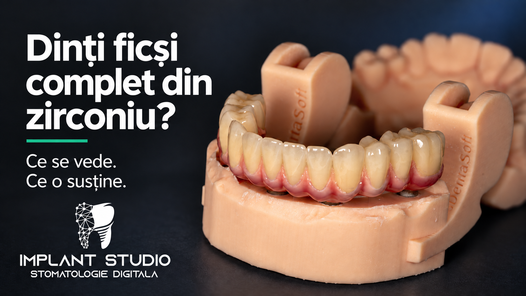 Lucrare fixă pe implanturi cu dinți din zirconiu pe structură de BioHPP