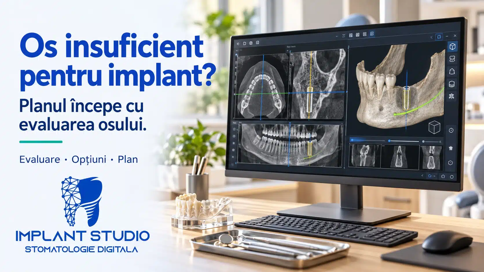 Tomografie dentară 3D folosită pentru măsurarea osului înainte de inserarea unui implant